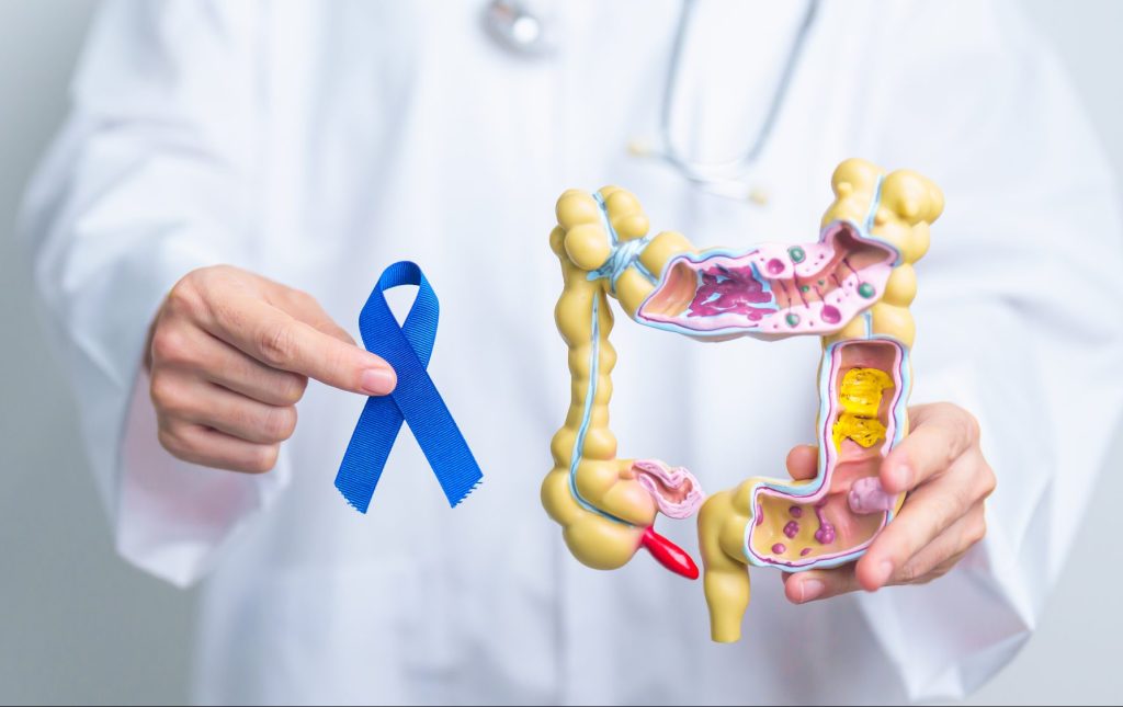 Doctor holding Blue ribbon with human Colon anatomy model. 